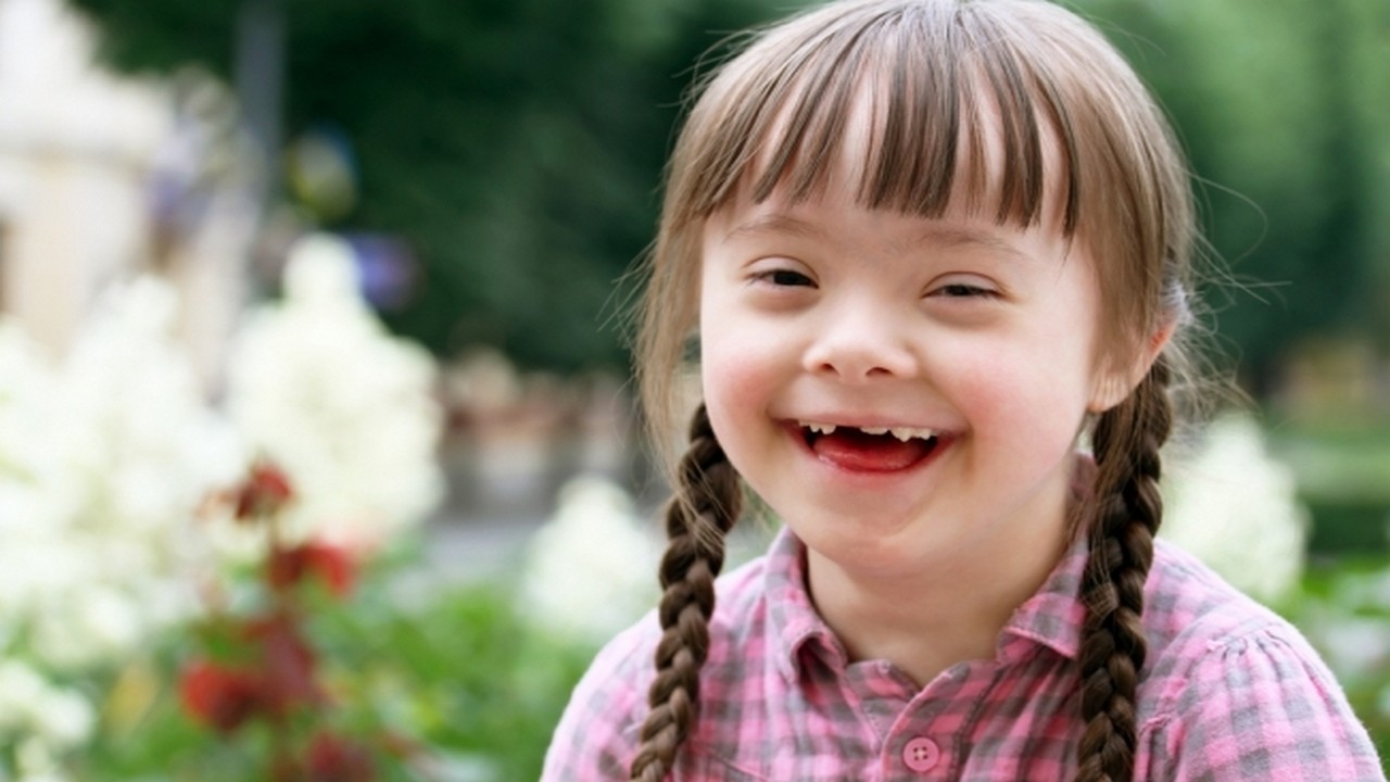У Полтаві відбудеться благодійний бал для дітей із синдромом Дауна